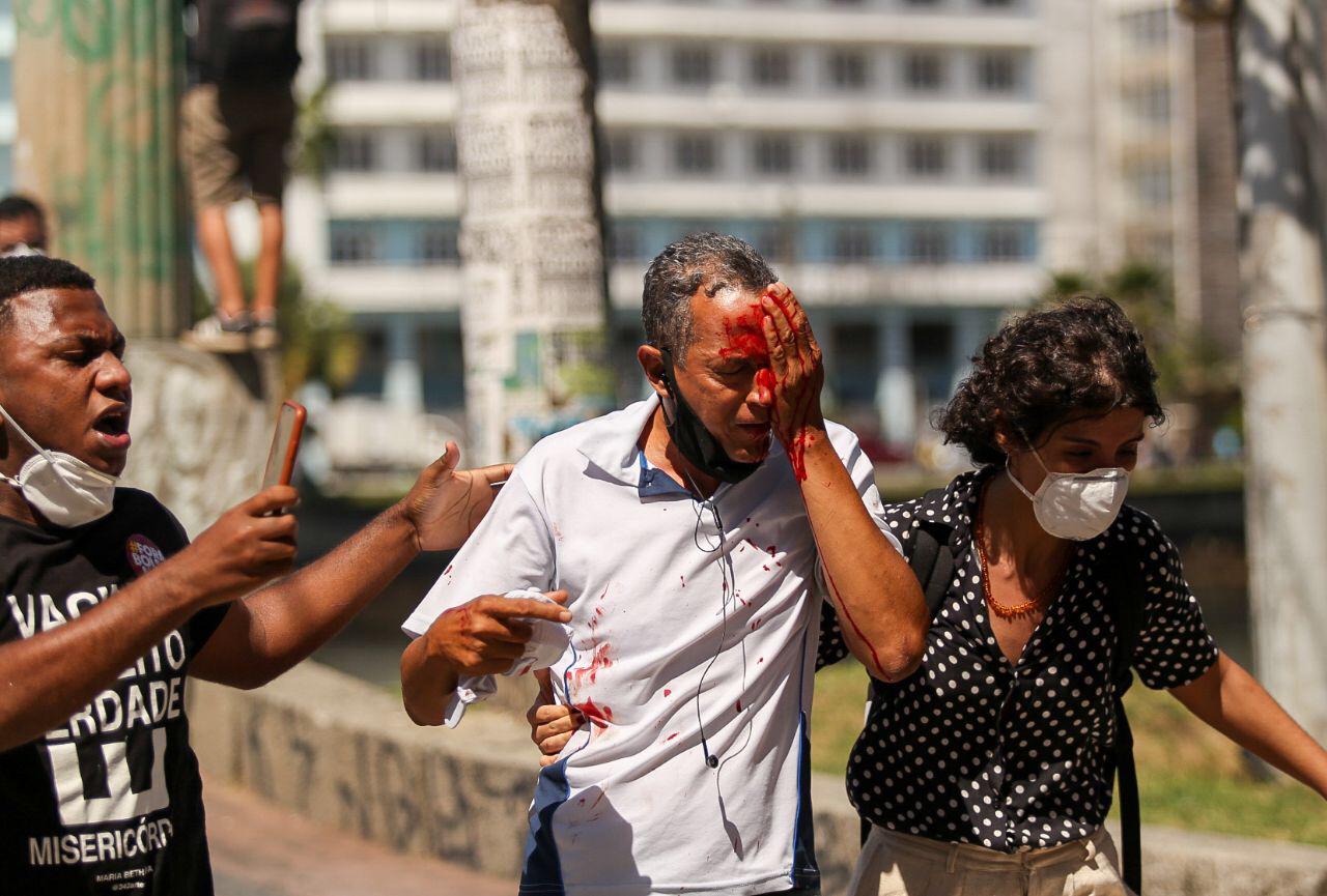 Homem baleado pela PM em Recife perdeu o olho, mas nem estava na manifestação