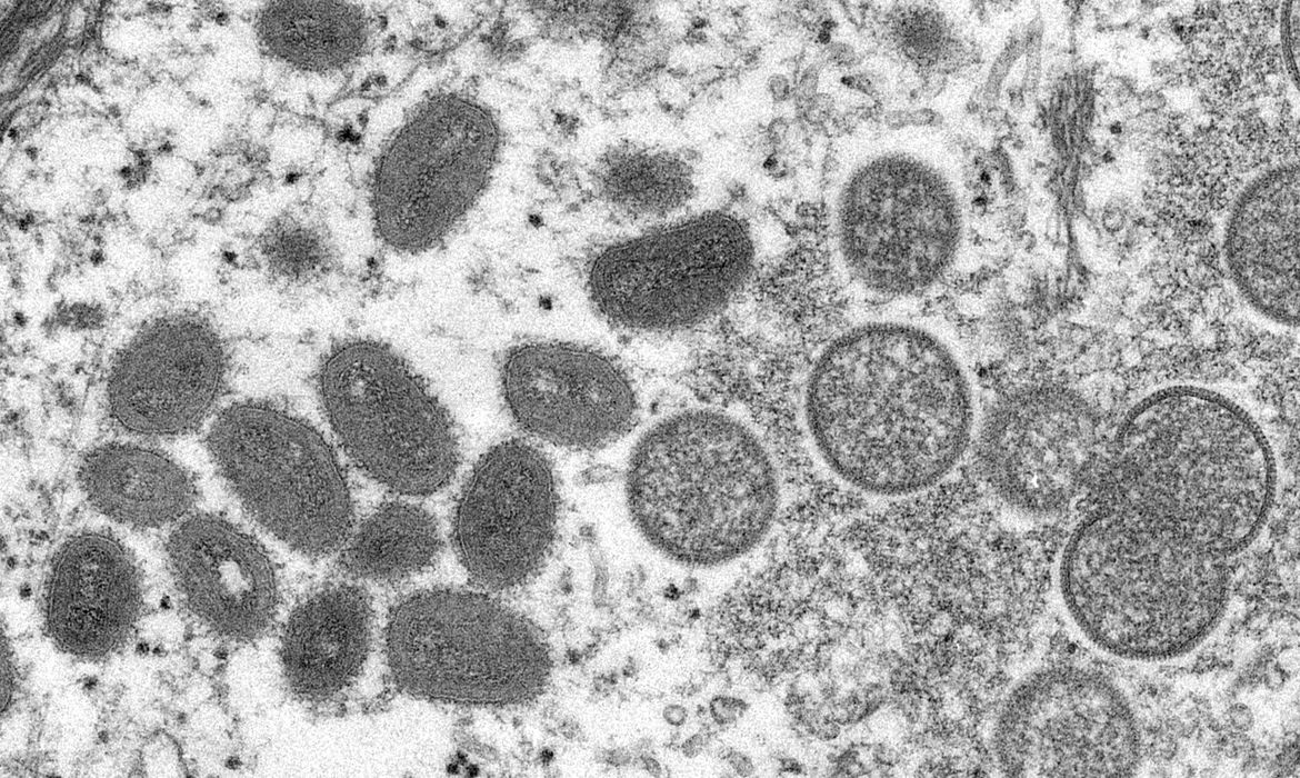 RN tem 4 casos confirmados da varíola dos macacos e transmissão comunitária