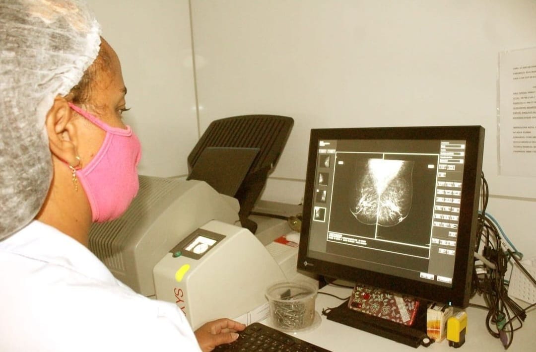 RN é o segundo estado do Nordeste com menor número de mamógrafos em uso