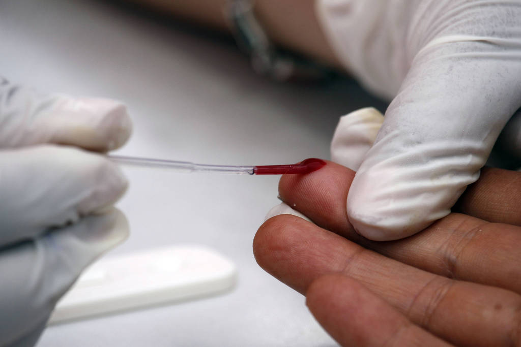 Casos de HIV explodem no RN e crescem 553% em 10 anos